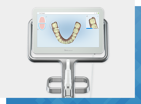 iTero導入で従来よりも負担の少ない口腔スキャンが可能！