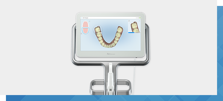 iTero導入で従来よりも負担の少ない口腔スキャンが可能！